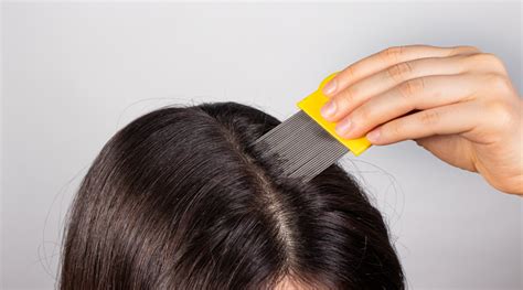 How To Treat An Itchy Scalp Healthkart