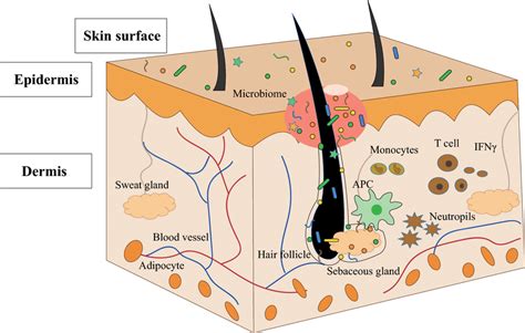 Skin Structure And Pathogenesis Of Acne The Skin Structure Consists Of