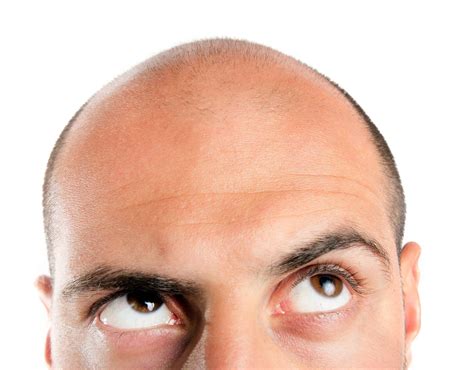 Your blood vessels, skin cells, and oil glands are all responsible for strong and healthy hair. Top Major Causes of Hair Loss in Men - Making Different