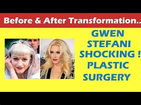 Jan 14, 2018 · the wedding is off! Gwen Stefani Plastic Surgery Before and After Full HD ...