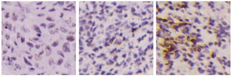 Murine study finds potential boost for ovarian cancer drug Olaparib