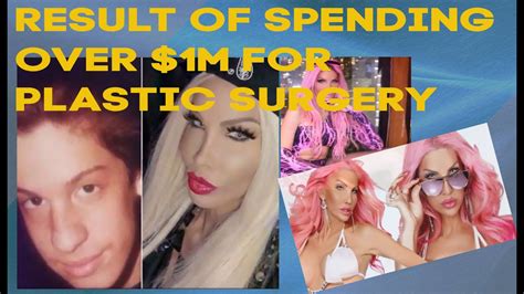 Botched Plastic Surgery The Transgender Who Spent Over 1m In Plastic