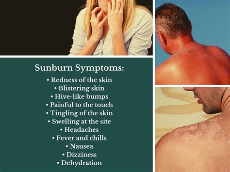 Symptoms Of Sun Poisoning And Sunburn