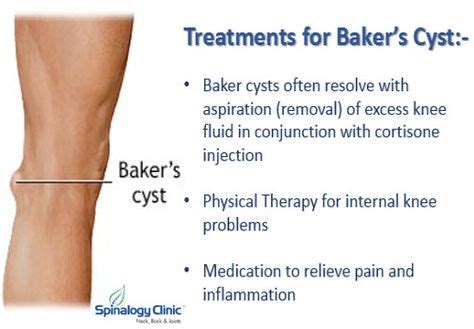 Bakers Cyst Ideas Baker S Cyst Cysts Bakers Cyst Treatment