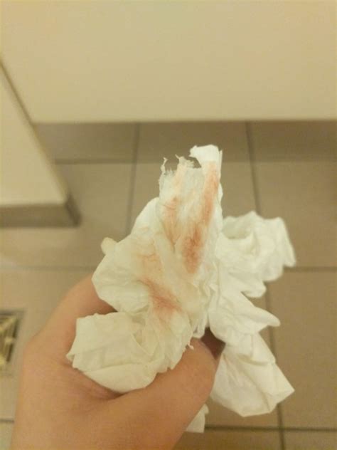 Implantation Bleeding Af Or Chemical Please Help Tmi Toilet Paper