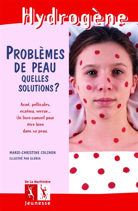 ProblÈmes De Peau Quelles Solutions Colinonmarie Christine Gloria Amazonca Books
