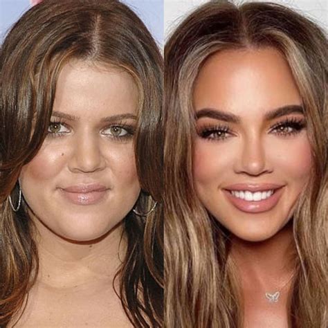 Khloe Kardashian Before Khloe Kardashian Before And After Plastic Surgery Butt Khloe