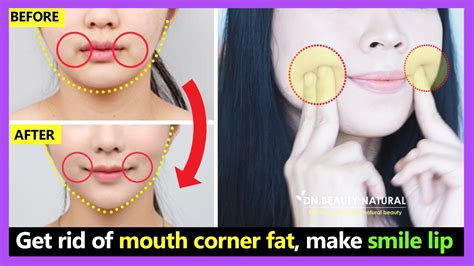 3 Minutes Get Rid Of Mouth Corner Fat Make Smile Lip And Lose Face