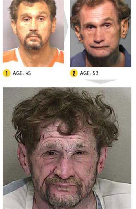 Drug Addiction Before And After Photos Show Shocking Reality Of