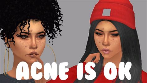 Sims 4 Create A Sim Acne Is Ok Youtube