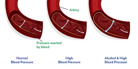 Does Alcohol Thin Your Blood Does Alcohol Raise Blood Pressure Ask