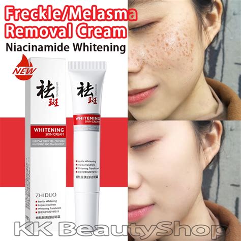 Effective Freckle Removal Cream Whitening Pekas Removal Melasma Dark Spots Brighten Skin Cream