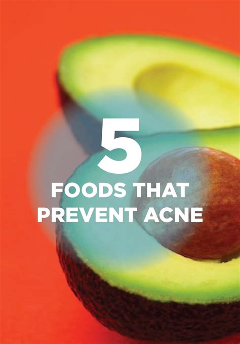 8 Foods That Help Prevent Acne Breakouts | Prevent acne, Acne, Skin care acne