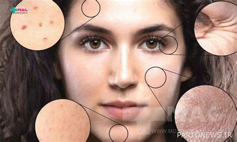 What Are The Most Common Skin Diseases پرتو نیوز