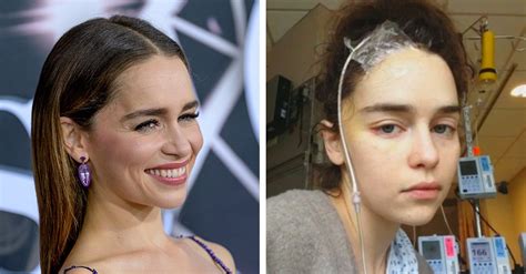 Emilia clarke can't stop laughing at kit harington flapping his pretend dragon wings if you can make it through this. Emilia Clarke Said Paramedics Made Her Laugh In Ambulance ...
