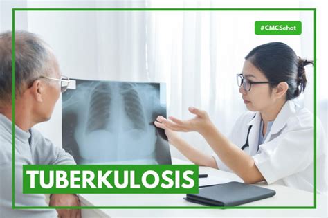 Fakta Penyakit Tbc Tuberkulosis Yang Harus Diketahui