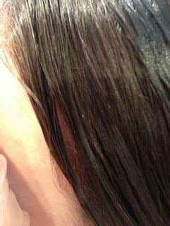 Lice Eggs In African American Hair | African american ...