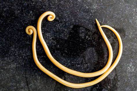 The body is sometimes able to fight off mild infestations, especially if home treatment is provided. How to Get Rid of Roundworms