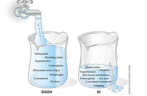 Difference Between Siadh And Diabetes Insipidus Effective Health