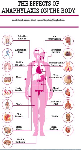 Anaphylaxis exclusion criteria · blood transfusion reactions that are not anaphylaxis · symptoms raised rash (patchy or onset over >1 hour); Living With Cold Urticaria Blog