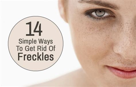 12 Home Remedies To Get Rid Of Freckle On Face Getting Rid Of Freckles Freckles Whiteheads