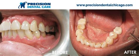 Industry:cosmetic dentist, dentures, dentists, endodontics. Precision Dental Care | The Best Dentists in Chicago IL