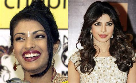 Bollywood Actresses Shocking Photos Before And After Plastic Surgery
