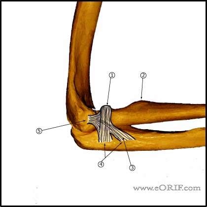 Radial Head Fracture ORIF 24665 | eORIF