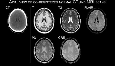 Mri uses a powerful magnetic field, radio frequency pulses and a computer to produce images of your organs, soft tissue, bone and internal structures. Cat Scan Vs Mri - Cat and Dog Lovers