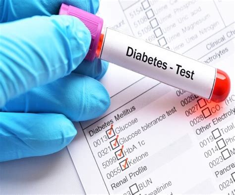Expert Panel Lowers Routine Screening Age For Diabetes To 35