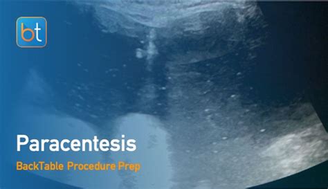 Paracentesis Procedure Steps Backtable