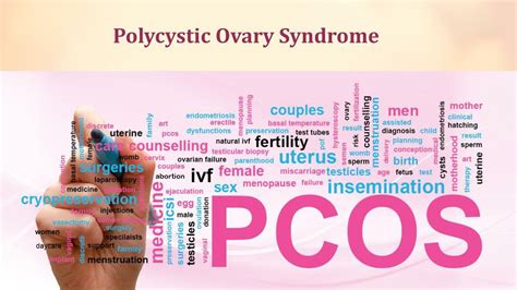 Ppt Polycystic Ovary Syndrome Pcos Powerpoint Presentation Free