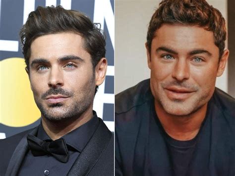 zac efron before and after plastic surgery celebrity plastic sexiezpicz web porn