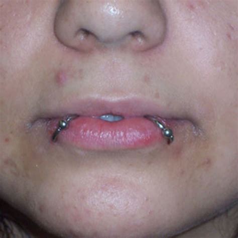 Vomiting, blurred vision, tingling of the limbs. Snake Bites Piercing: Risks, Aftercare, and Jewelry Advice ...