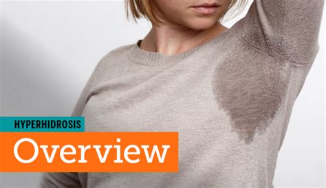 Your Guide To Hyperhidrosis Symptoms Treatments And More