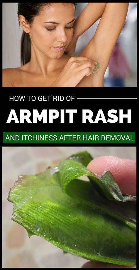 How To Get Rid Of Armpit Rash And Itchiness After Hair Removal