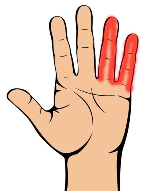 99 arti telapak tangan kiri sering gatal menurut primbon dan dalam islam. Inilah 7 Petanda Penyakit Yang Kita Boleh Tahu Hanya ...