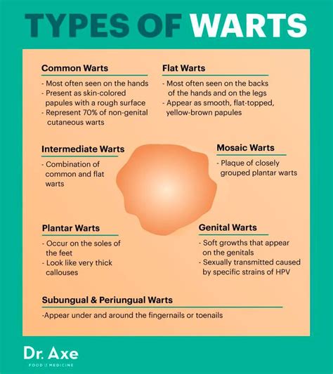 How To Identify Different Types Of Warts