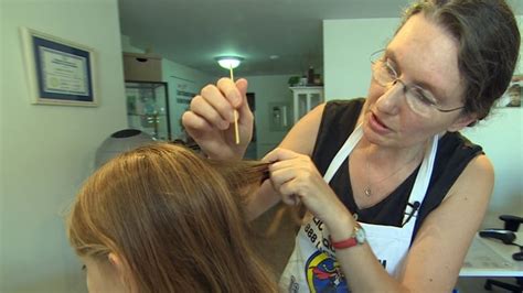 Head Lice How To Identify It Treat It And Prevent It Cbc News