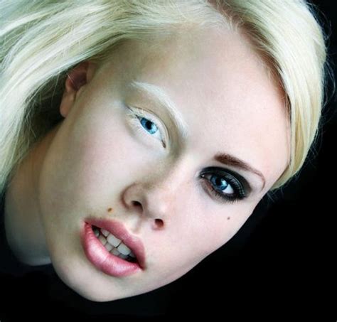 17 Best Images About Albinismo On Pinterest Albinism