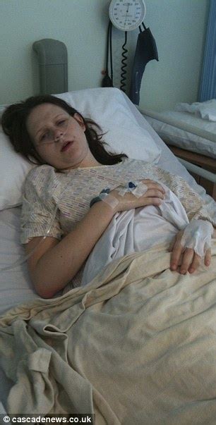 Woman Hasn T Eaten Food In 7 Years Because Her Stomach Muscles Are Paralysed Daily Mail Online