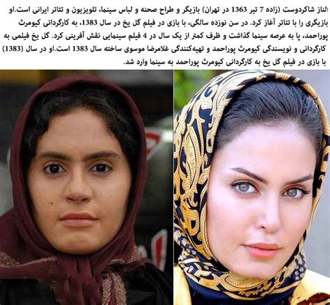 Plastic Surgery In Iran Before And After