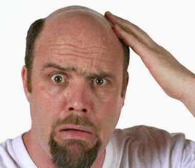 *kocok dahulu minyak sebelum digunakan *gunakan 2x sehari setelah mandi *bisa untuk bagian tubuh manapun yang berpotensi tumbuh rambut/bulu *bisa. Mengatasi Kebotakan | Perawatan rambut rontok, Rambut ...