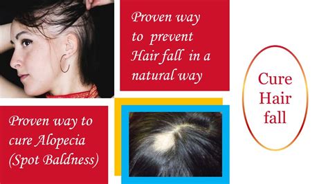 Proven Way To Cure Hair Fall And Alopecia Hairfall Baldness Remedy