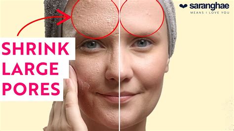 How To Shrink Large Pores Youtube