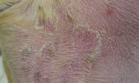 Scaling And Crusting Skin Disease Clinicians Brief