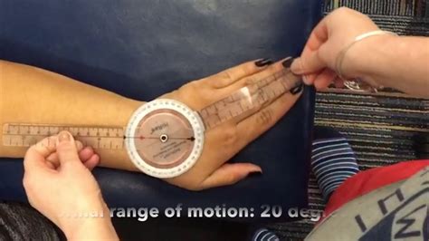 Wrist Ulnar And Radial Deviation Paquette Youtube