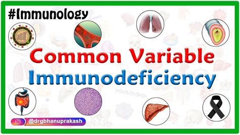 Common Variable Immunodeficiency Cvid Usmle Step 1 Youtube