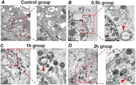 The Typical Tem Images Of Autophagosomes In Hepg2 Cells A The Hepg2
