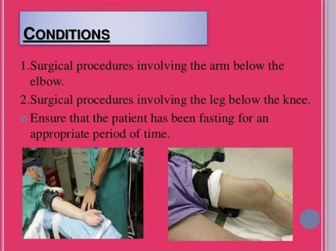 Bier Block Intravenous Regional Anesthesia